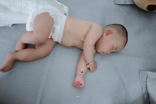 白城宝宝脸上有白色斑块
